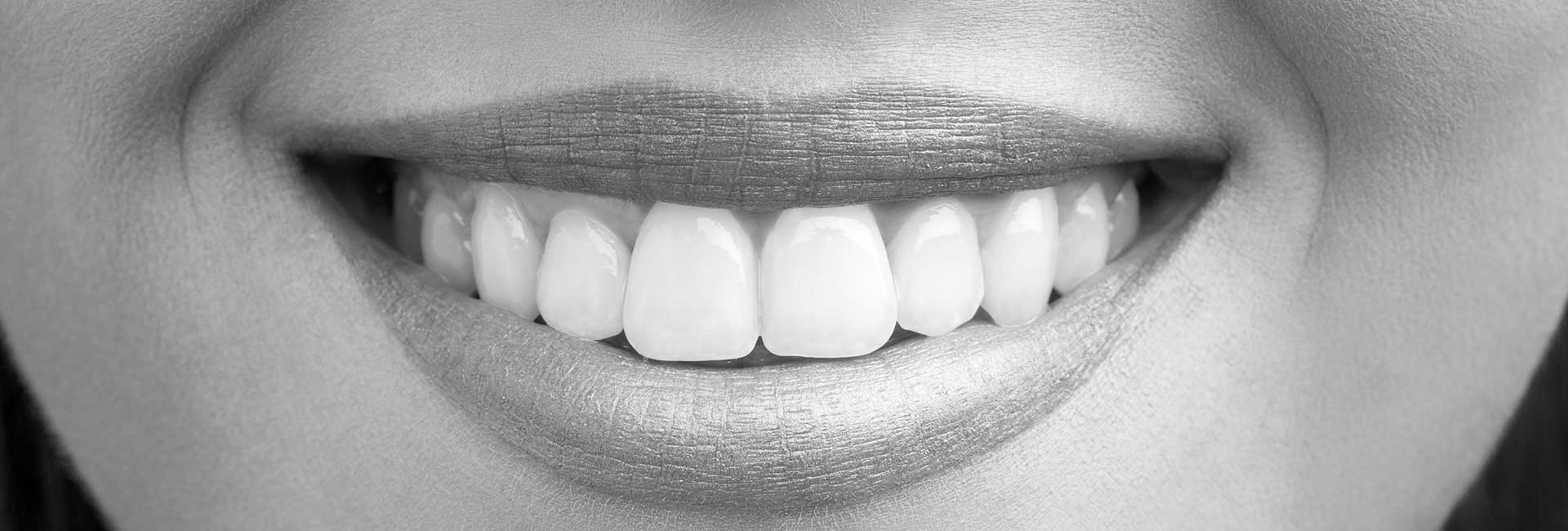Beauty woman look her beautiful teeth