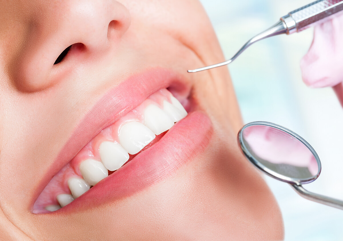 Teeth Whitening Benefits in Riverside CA Area